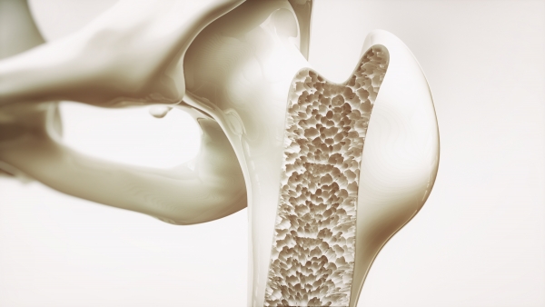 NWOS Osteoporosis 3D Rendering