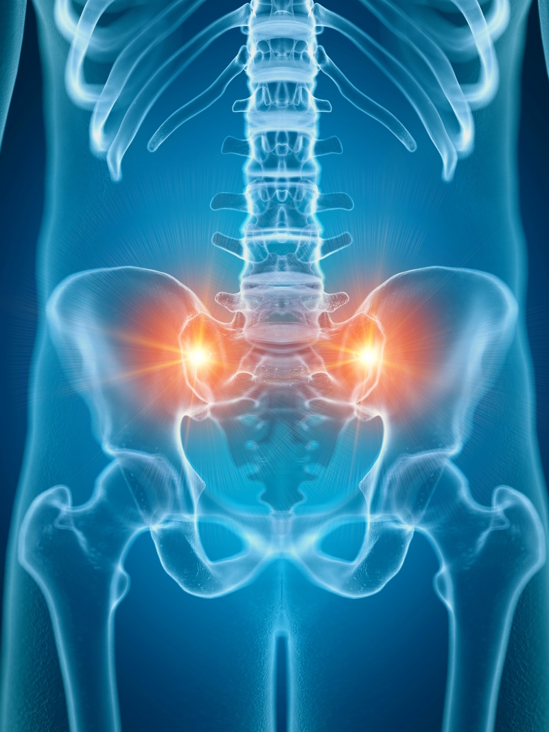 Sacroiliac Joint Dysfunction Northwest Orthopaedic Specialists 