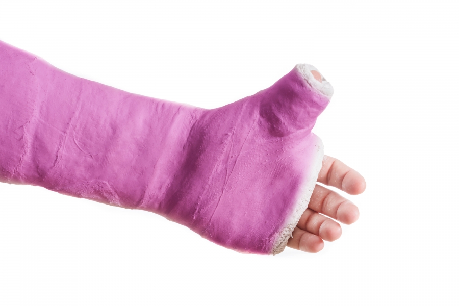 hot pink cast